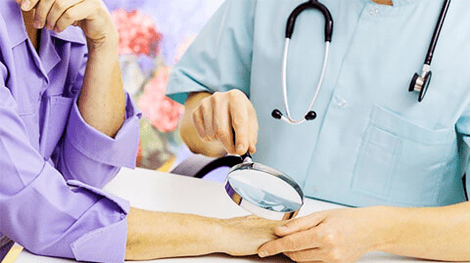 Diagnos an d'Behandlung vu Papillomas